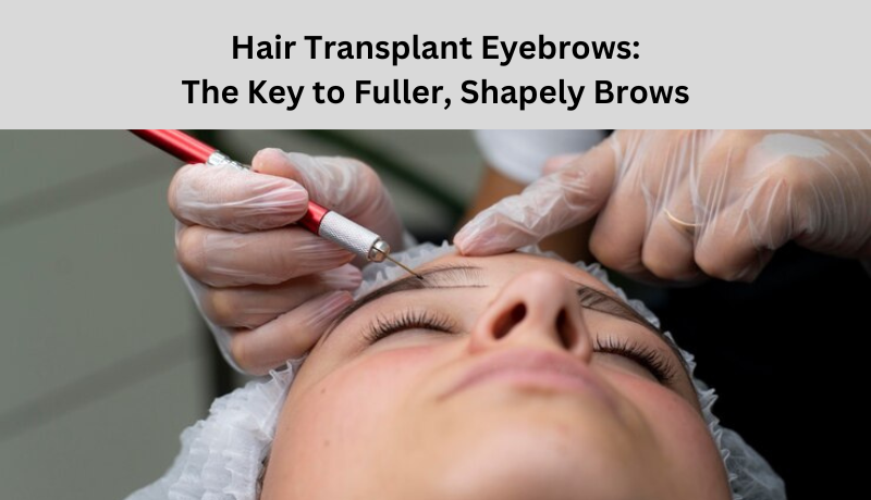 hair transplant eyebrows