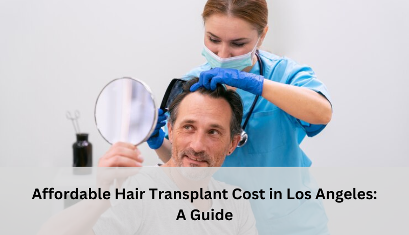 hair transplant Los Angeles cost