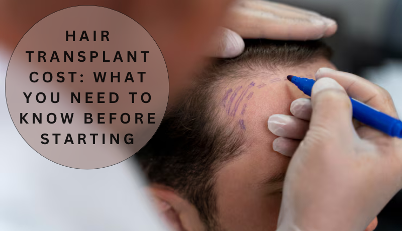 hair transplant cost